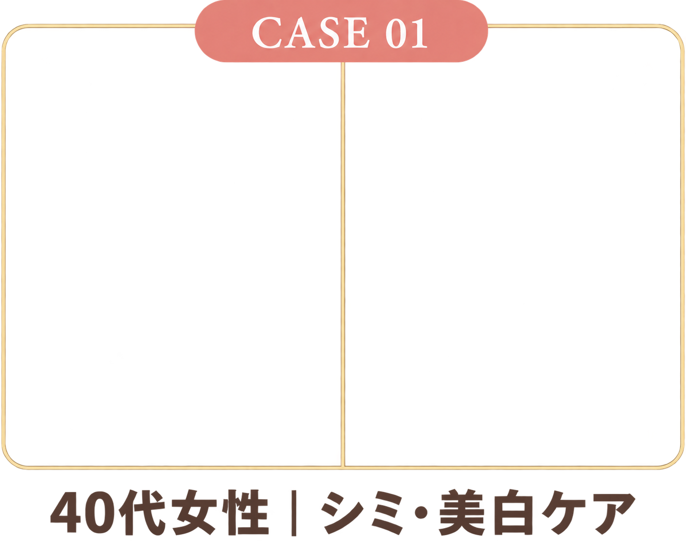 施術例 1