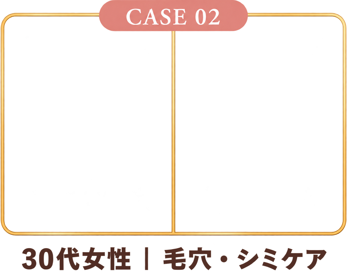 施術例 2