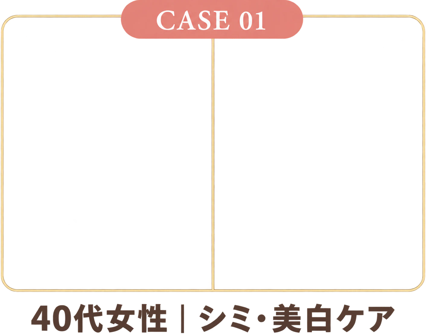 施術例 1