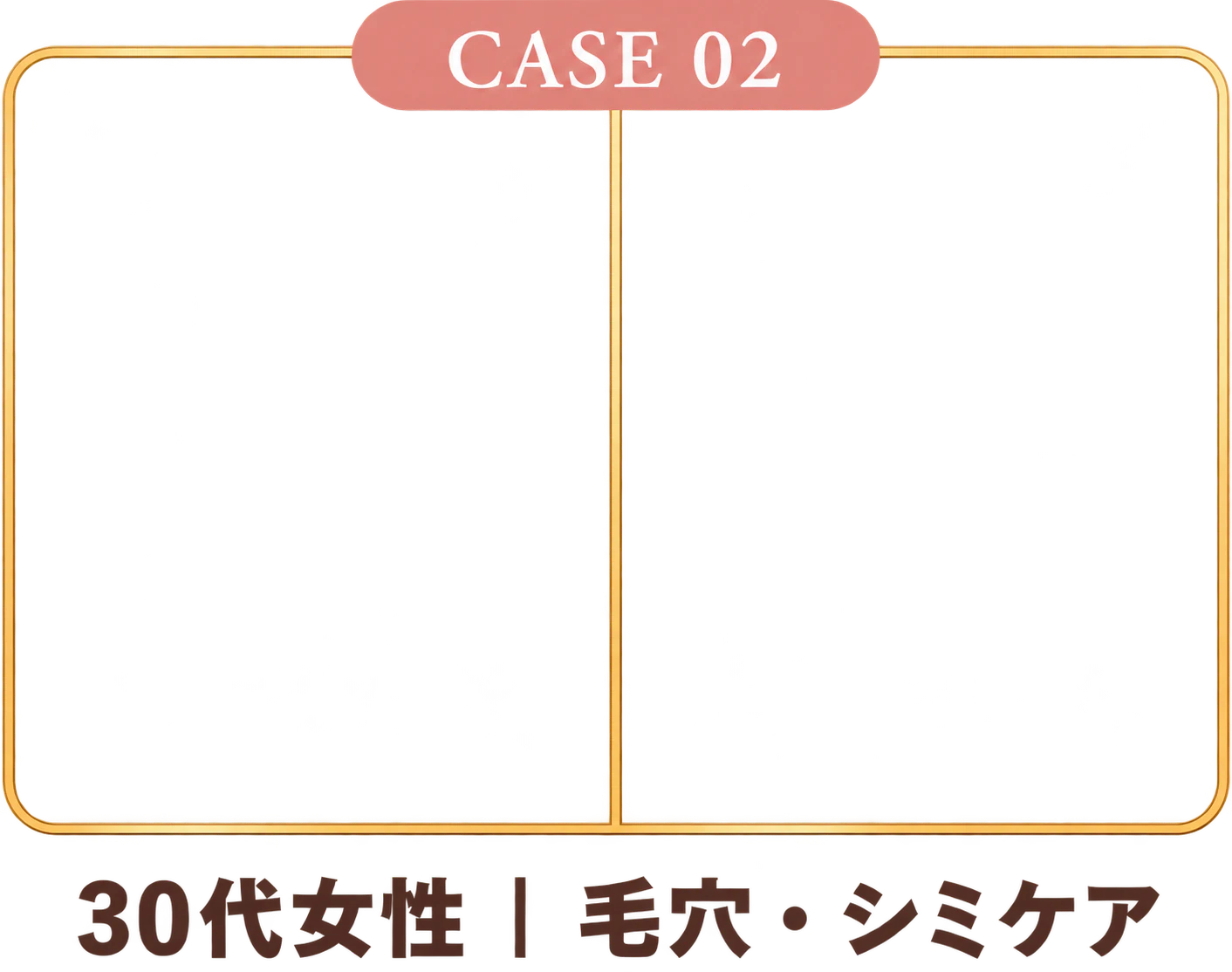 施術例 2